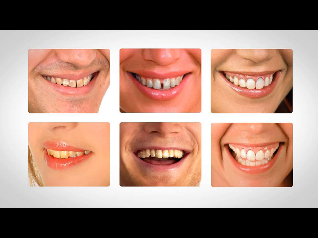 Previsualización del video de Estética dental